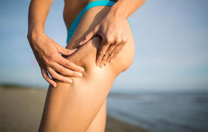 Cellulite - professional solutions